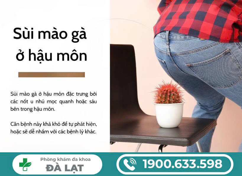 Hình ảnh minh họa